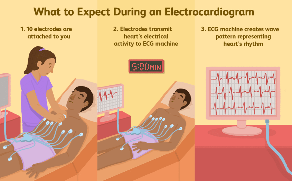 What Does Electrocardiogram Show