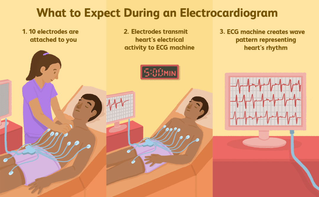 ecg-test-electrocardiography-test-cost-in-mumbai-chirayu-healthcare