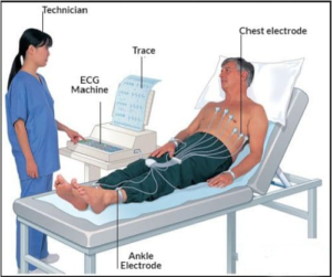 ECG Test - ECG Preparation and process
