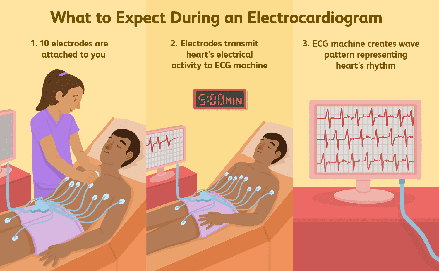 What Is Electrocardiogram And Electrocardiograph